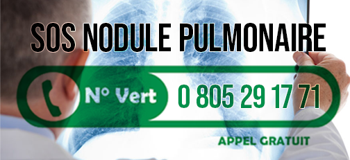 SOS nodule pulmonaire , téléphone 0 805 29 17 71